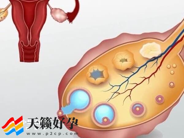 人授等同于试管婴儿？快来看，适用人群和手术方式都不同(图2)
