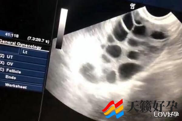 试管婴儿畸形形成原因分析，值得注意的四大因素(图1)