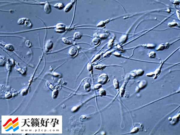 逆行射精的危害有哪些(图1)