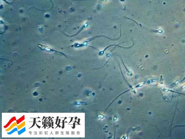 圆头精子症也能做试管婴儿，助孕成功率也不是很低！(图1)