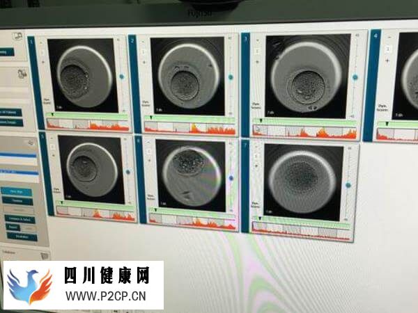 高龄试管成功率低是什么情况(图1)