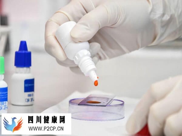 做二代试管男性有什么条件(图1)