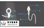 精子顶体酶异常会不会影响生育